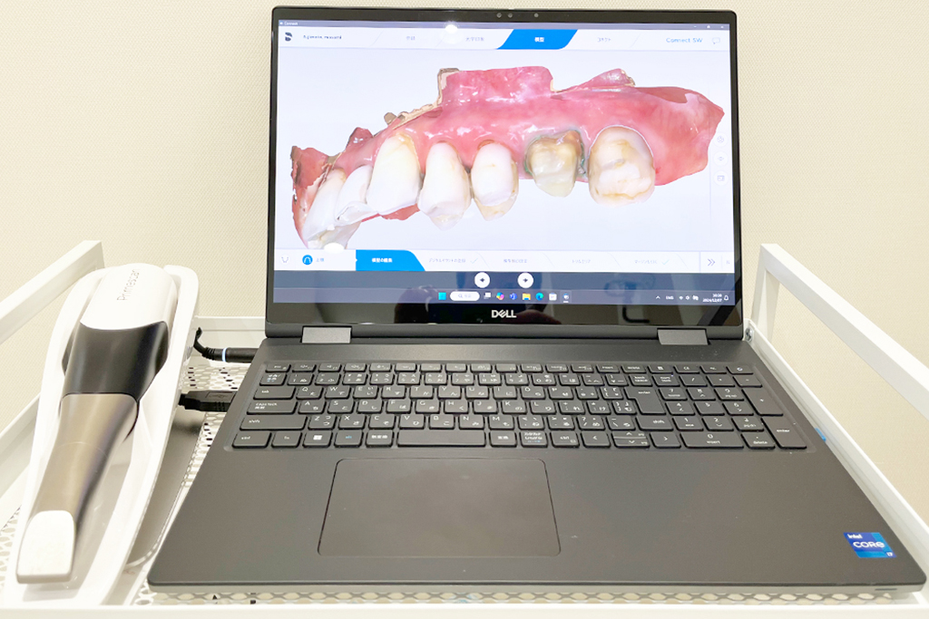 足立区六町・ほまれ歯科医院・口腔内スキャナー